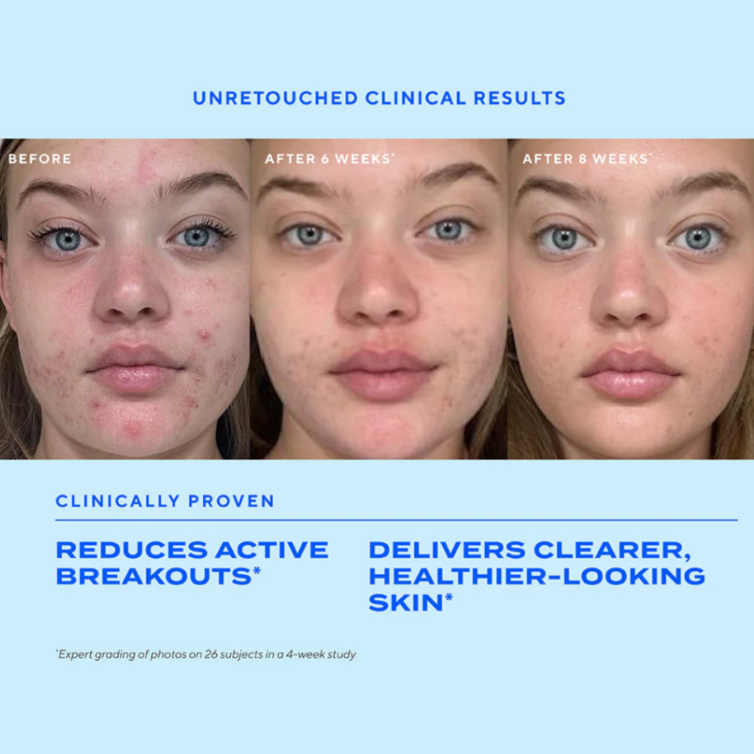 Murad Biome-Balancing Clear & Prevent Acne Treatment Serum