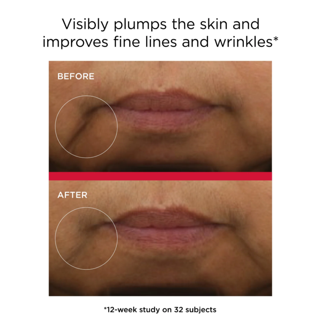 EltaMD UV Daily Hydration+