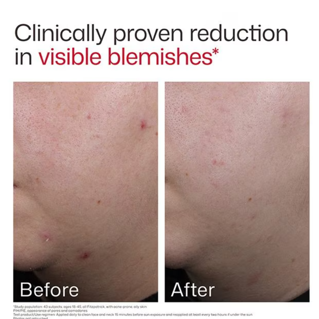 Eltamd UV Clear Blemish & Oil Balancing SPF 50