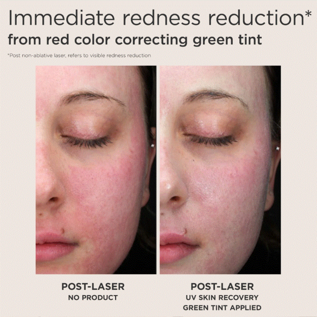 EltaMD UV Recovery Red Color Correcting Green Tint Broad Spectrum SPF 50