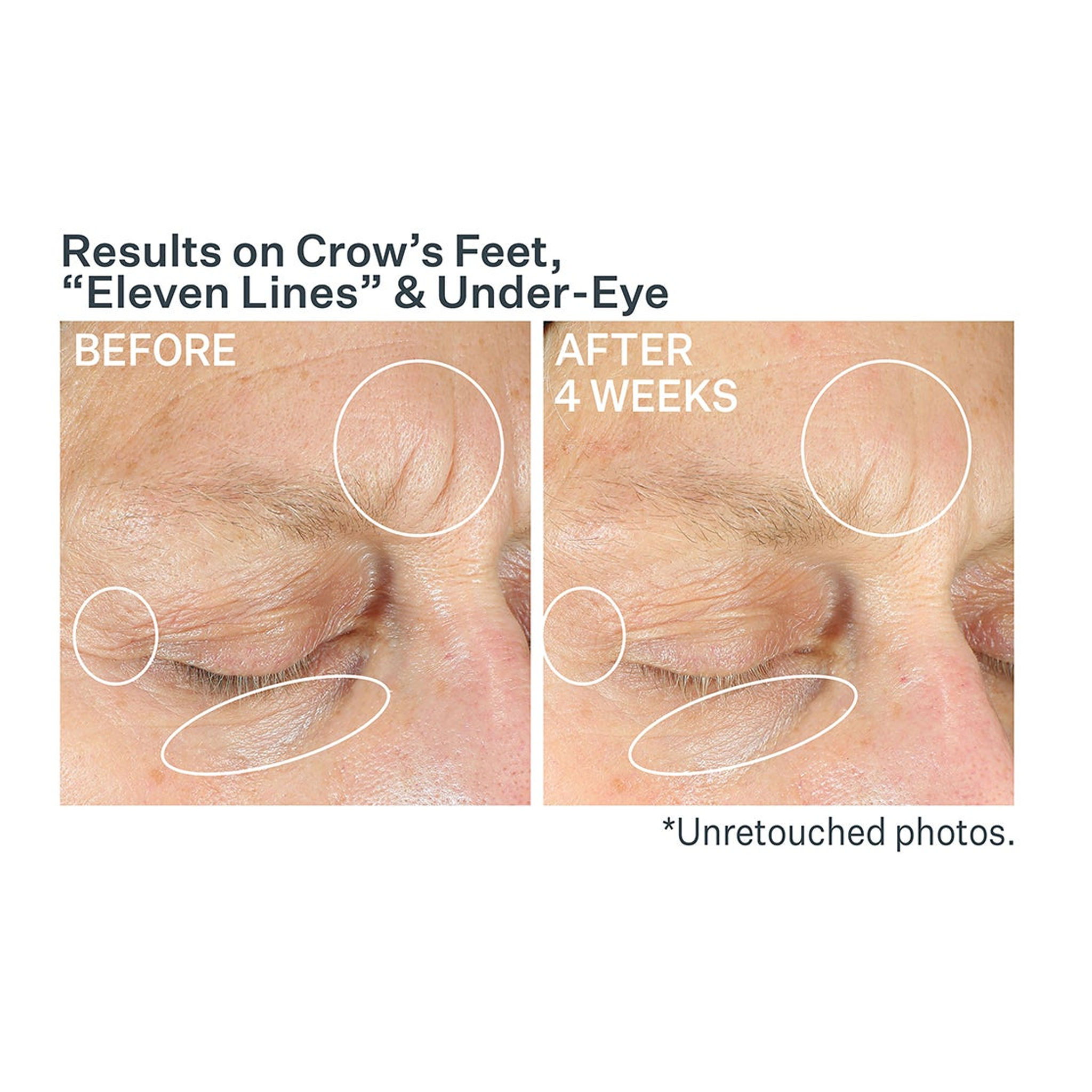 StriVectin Anti-Wrinkle Intensive Eye Concentrate For Wrinkles PLUS