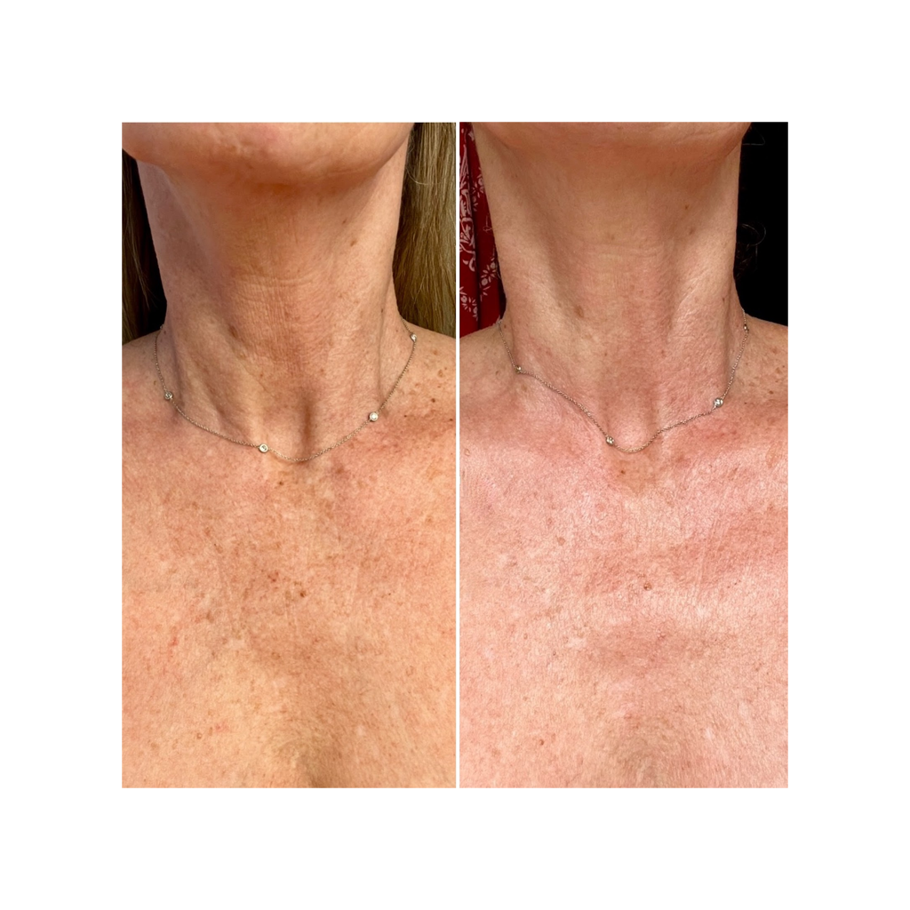 Osmosis Hydrafirm Smoothing Cream