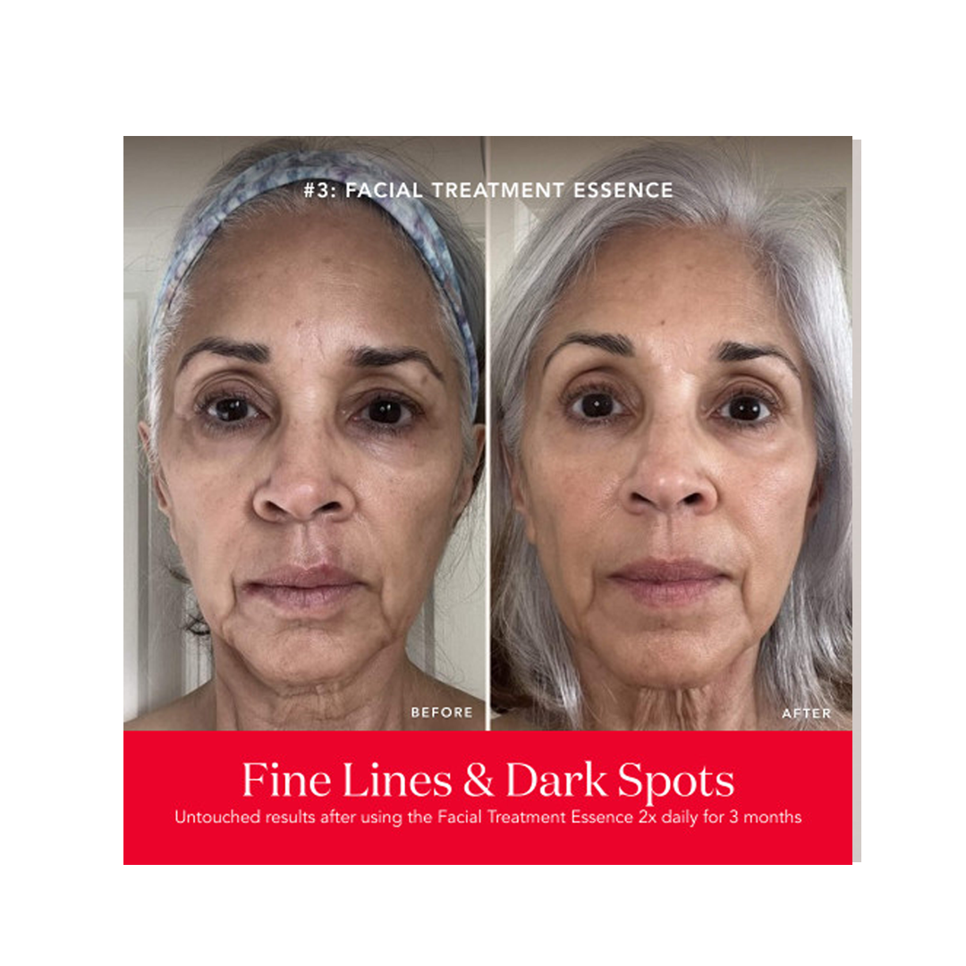 SK-II PITERA Anti-Aging Set: Best Skincare Bundle