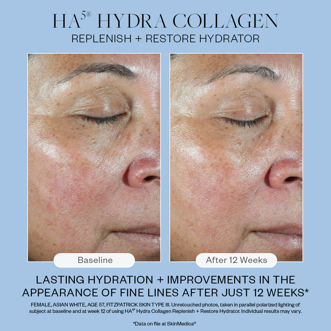 SkinMedica Travel Size HA5 Hydra Collagen Replenish & Restore Hydrator (0.3 fl.oz)