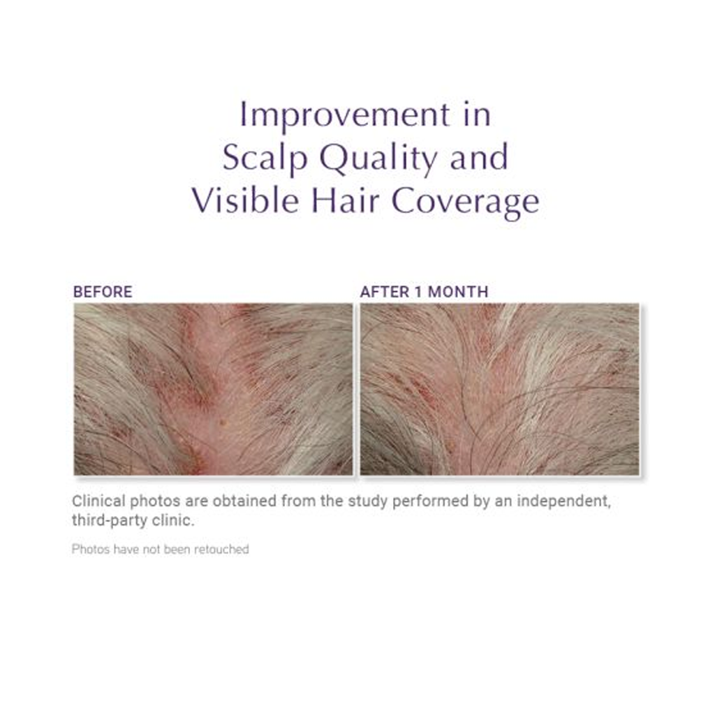 DefenAge 150K Hair Follicle Serum