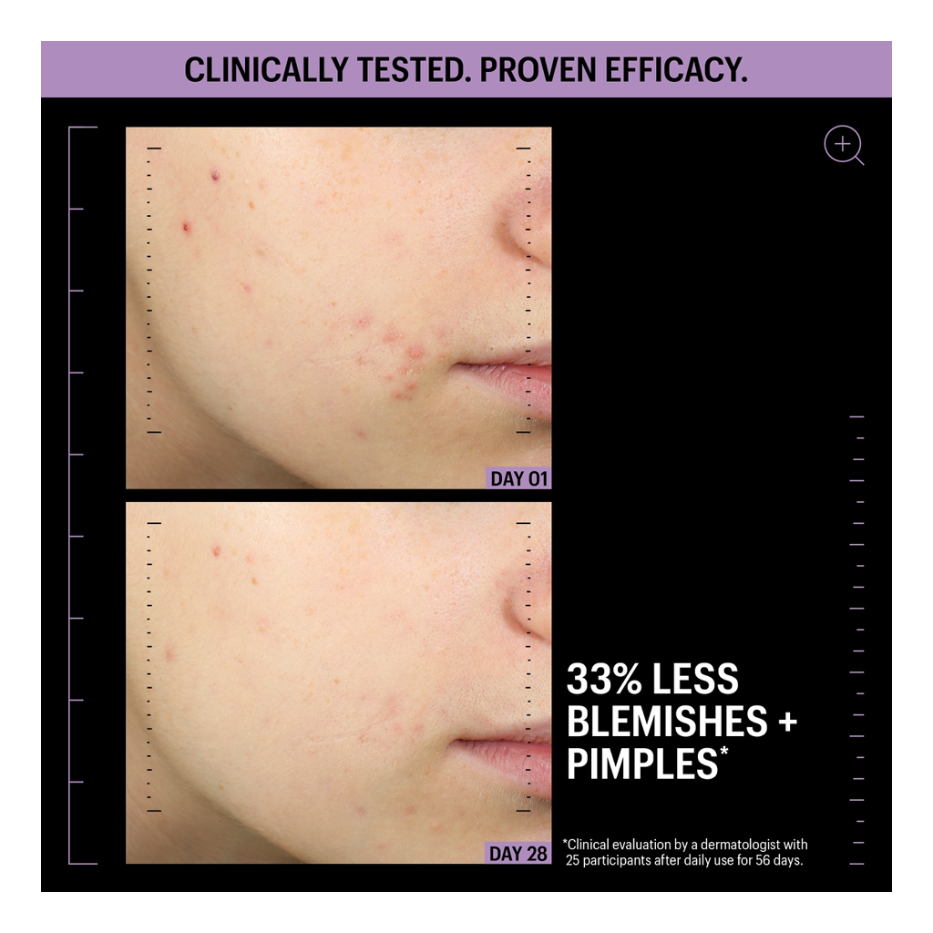 Allies of Skin Azelaic & Kojic Advanced Clarifying Serum