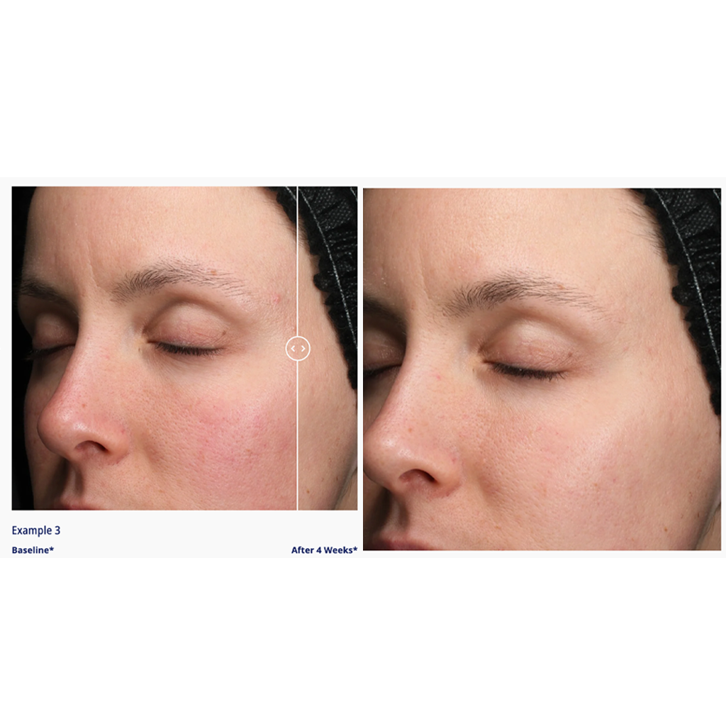 Obagi Retinol + PHA Refining Night Cream