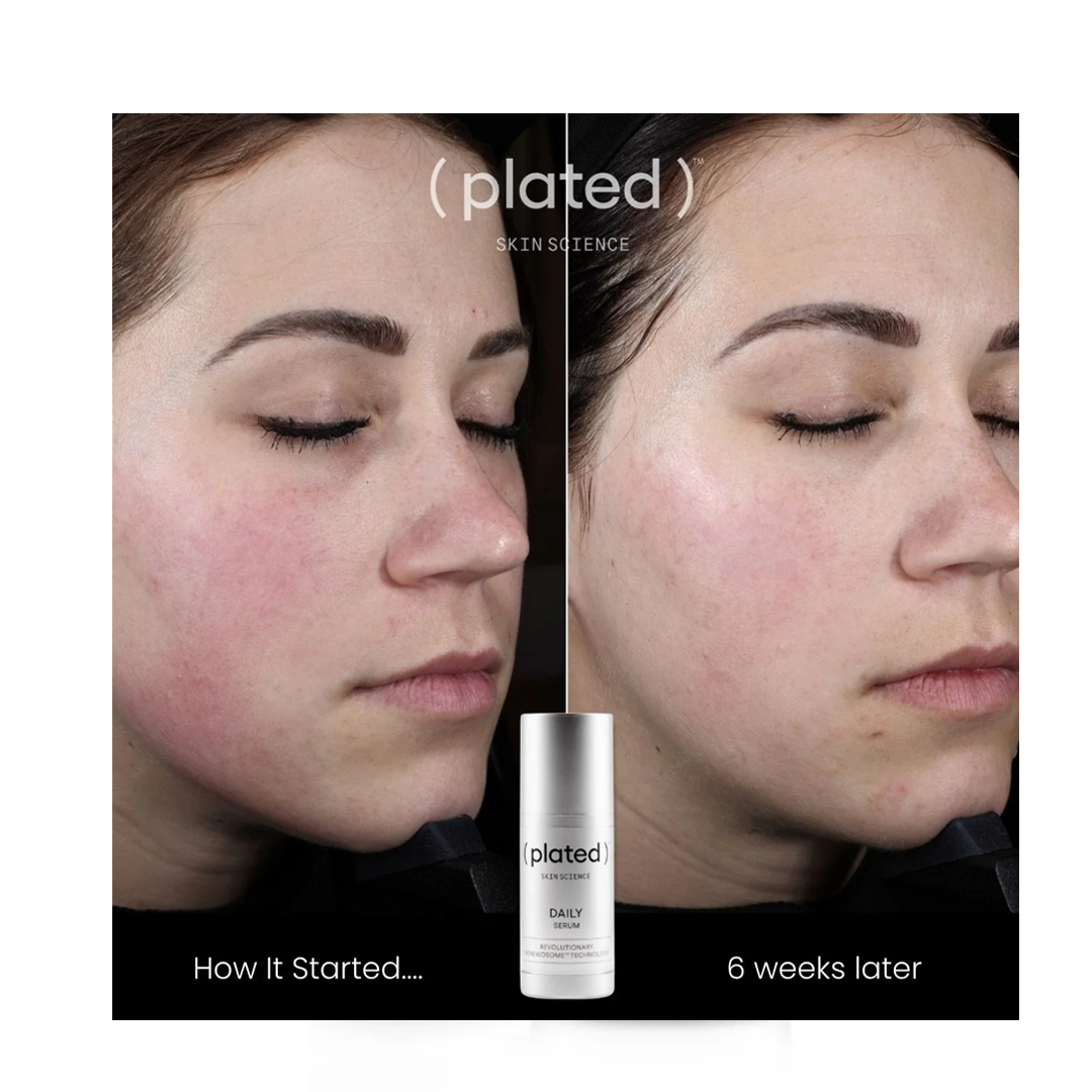Plated DAILY Serum