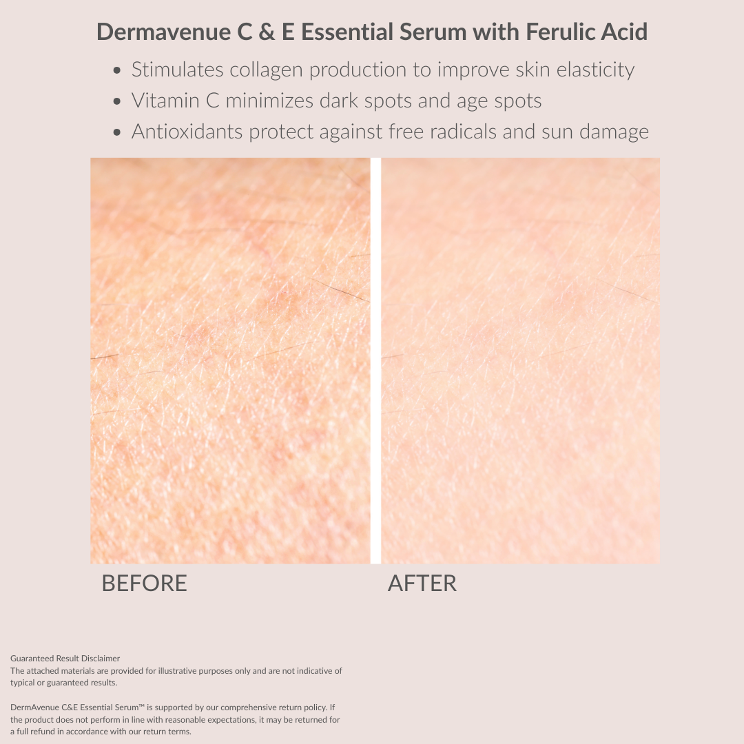 SkinCeuticals C E Ferulic 1 fl oz. SOLD OUT-Buy 1 Dermavenue C E Essential Serum Get a Your Second Bottle FREE