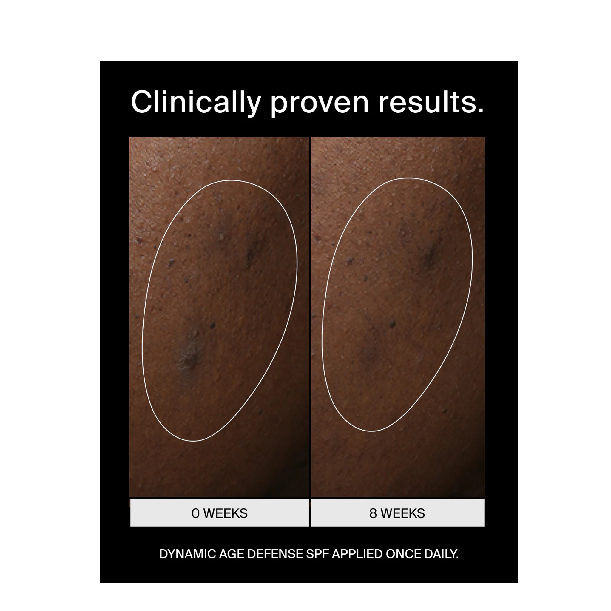 Pavise Dynamic Age Defense Refill