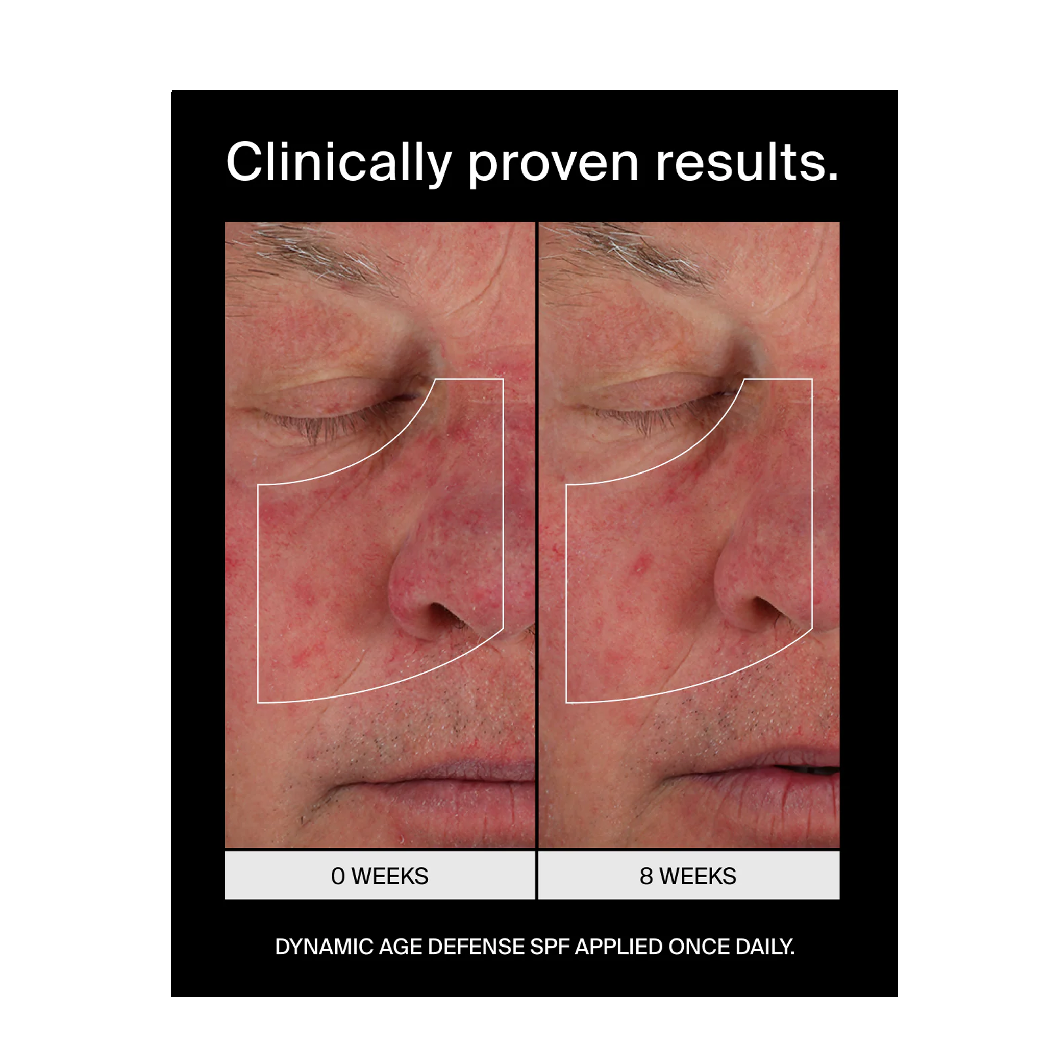 Pavise Dynamic Age Defense