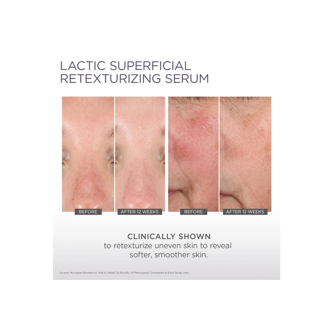 Glytone Lactic Superficial Retexturizing Serum