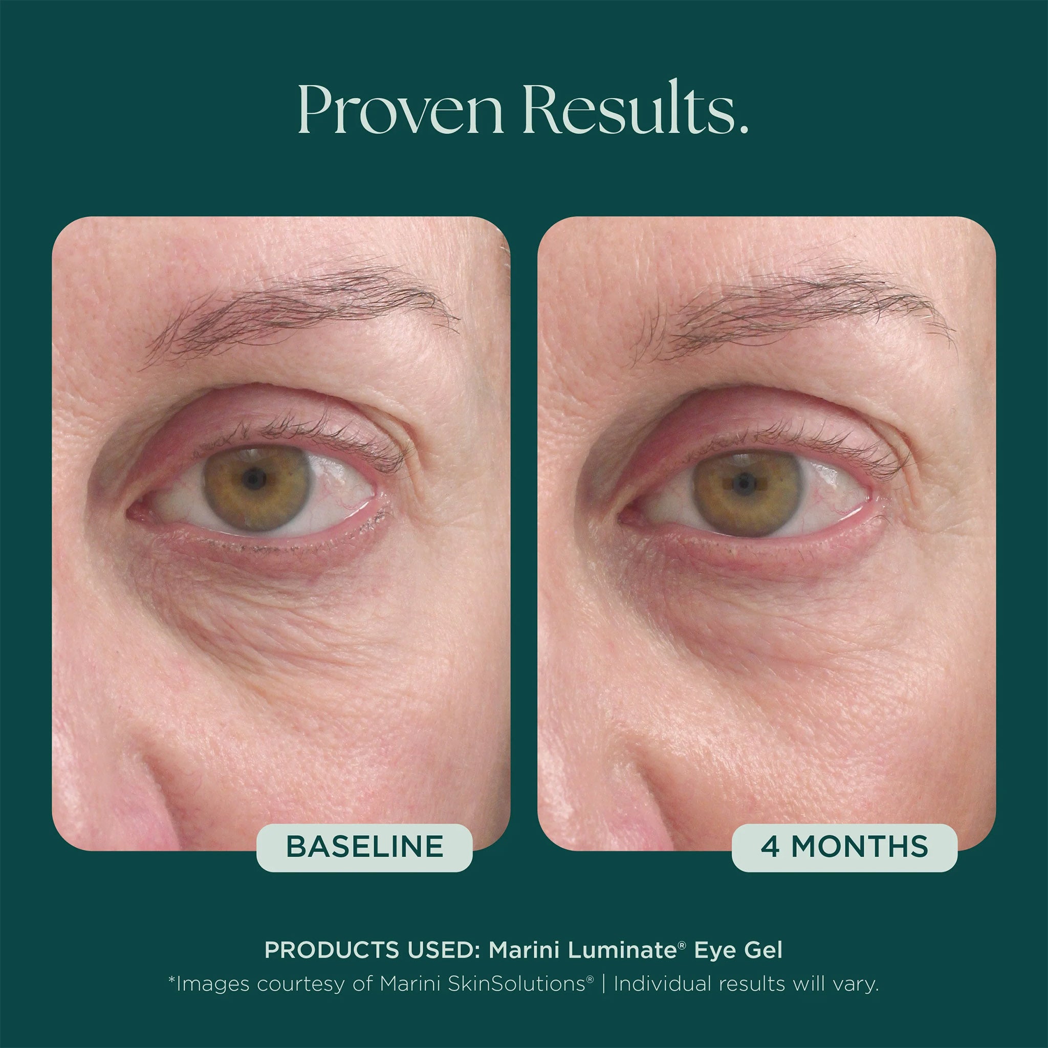 Marini SkinSolutions Luminate Eye Gel