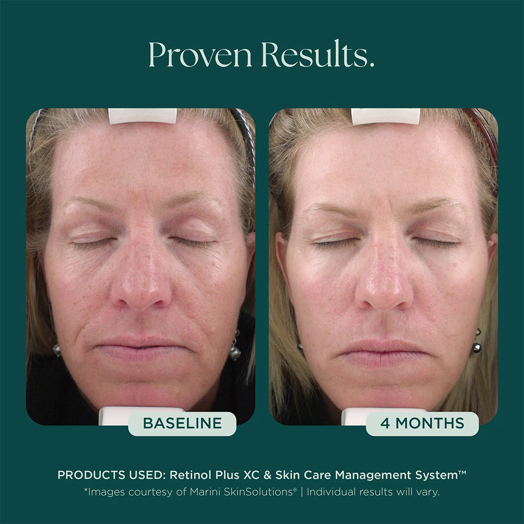 Marini SkinSolutions Retinol Plus XC