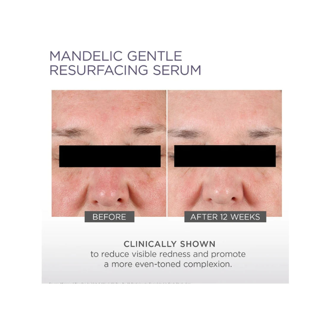 Glytone Mandelic Gentle Resurfacing Serum