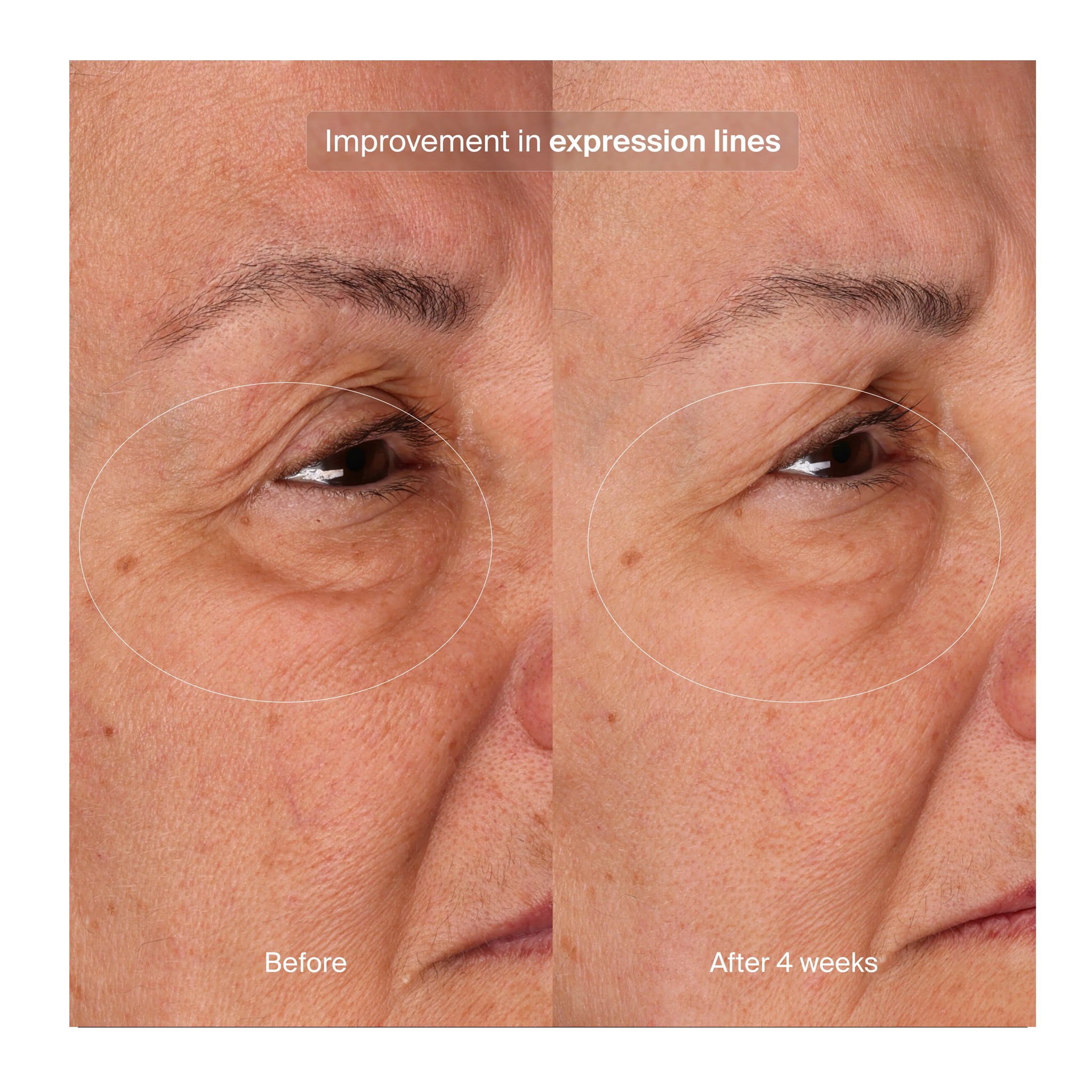 Pavise Bioadaptive Stress Repair