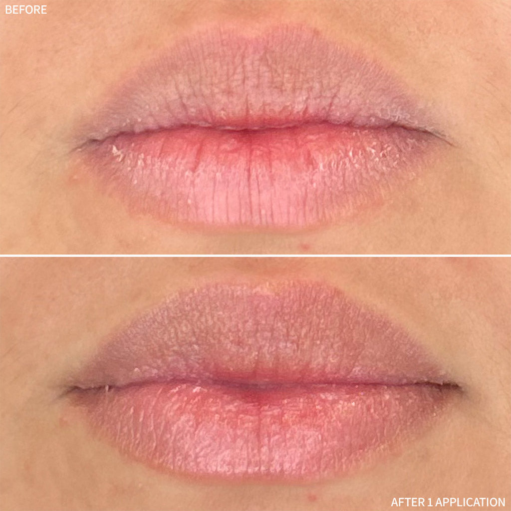 RescueMD Restorative Lip Treatment