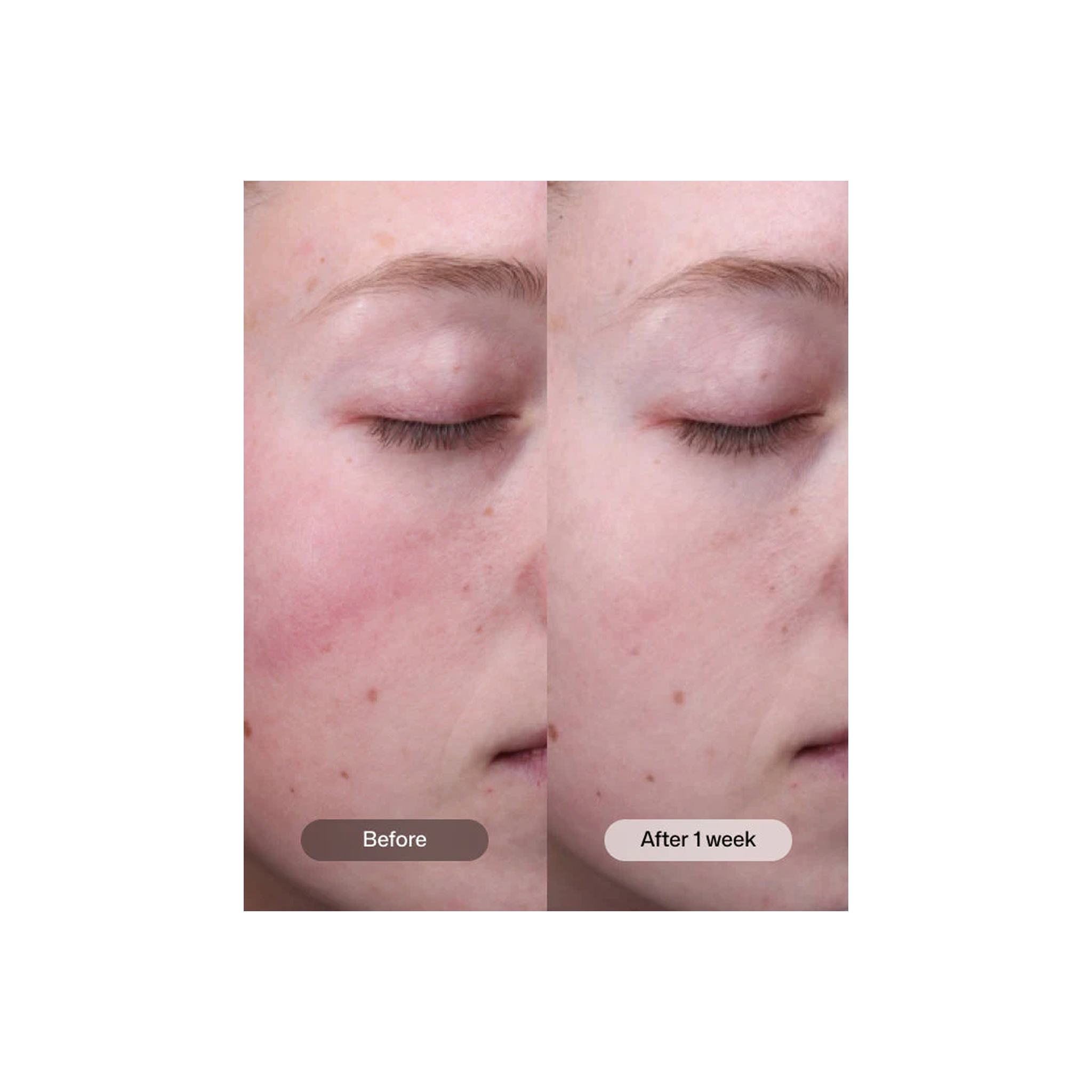 Revision Skincare Radiance+ Resurfacing Serum