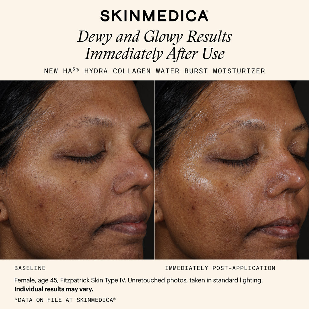 SkinMedica HA5 Hydra Collagen Water Burst Moisturizer