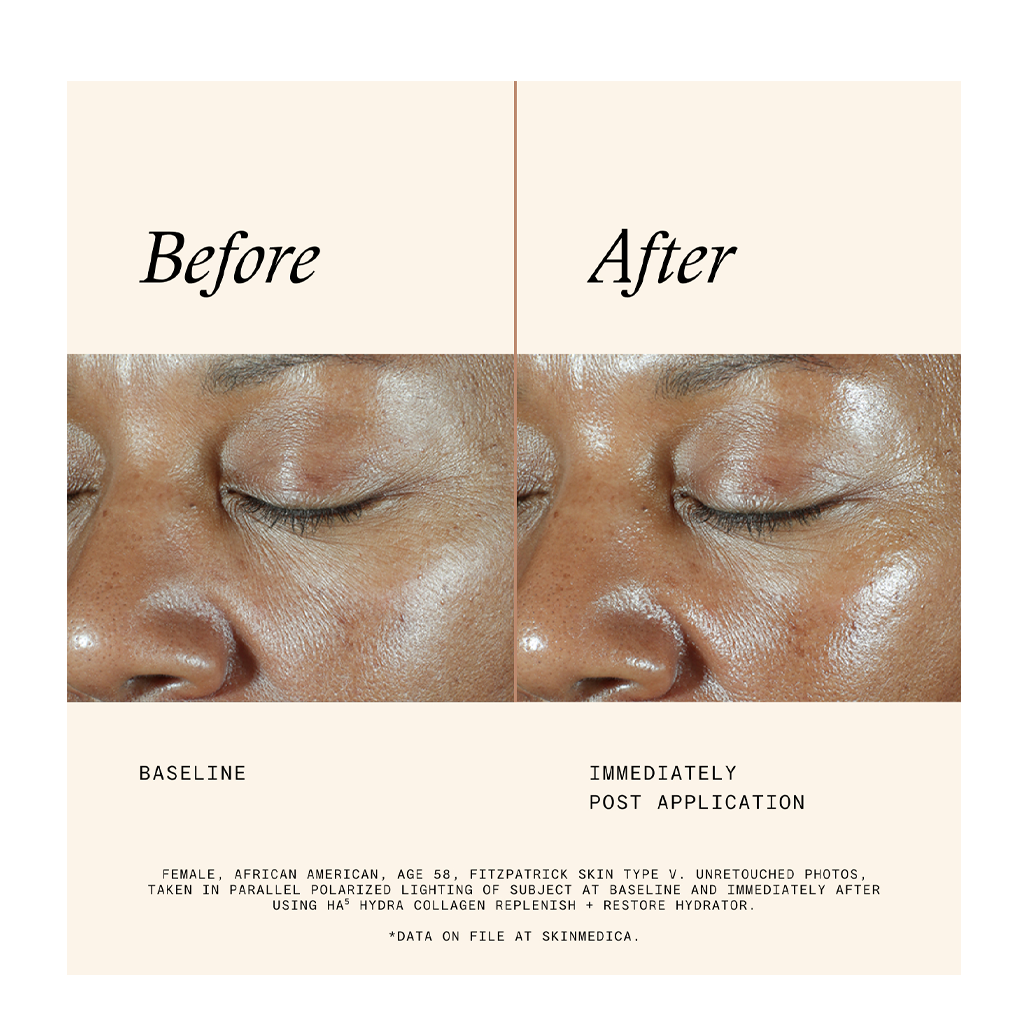 SkinMedica HA5 Hydra Collagen Replenish & Restore Hydrator