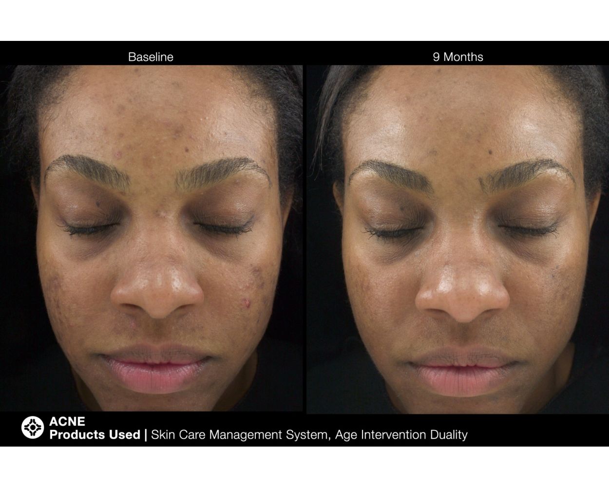 Jan Marini Age Intervention Duality