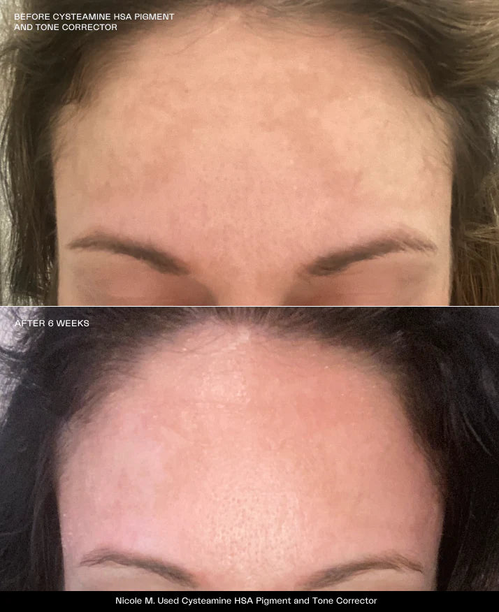 Sente Cysteamine HSA Pigment & Tone Corrector