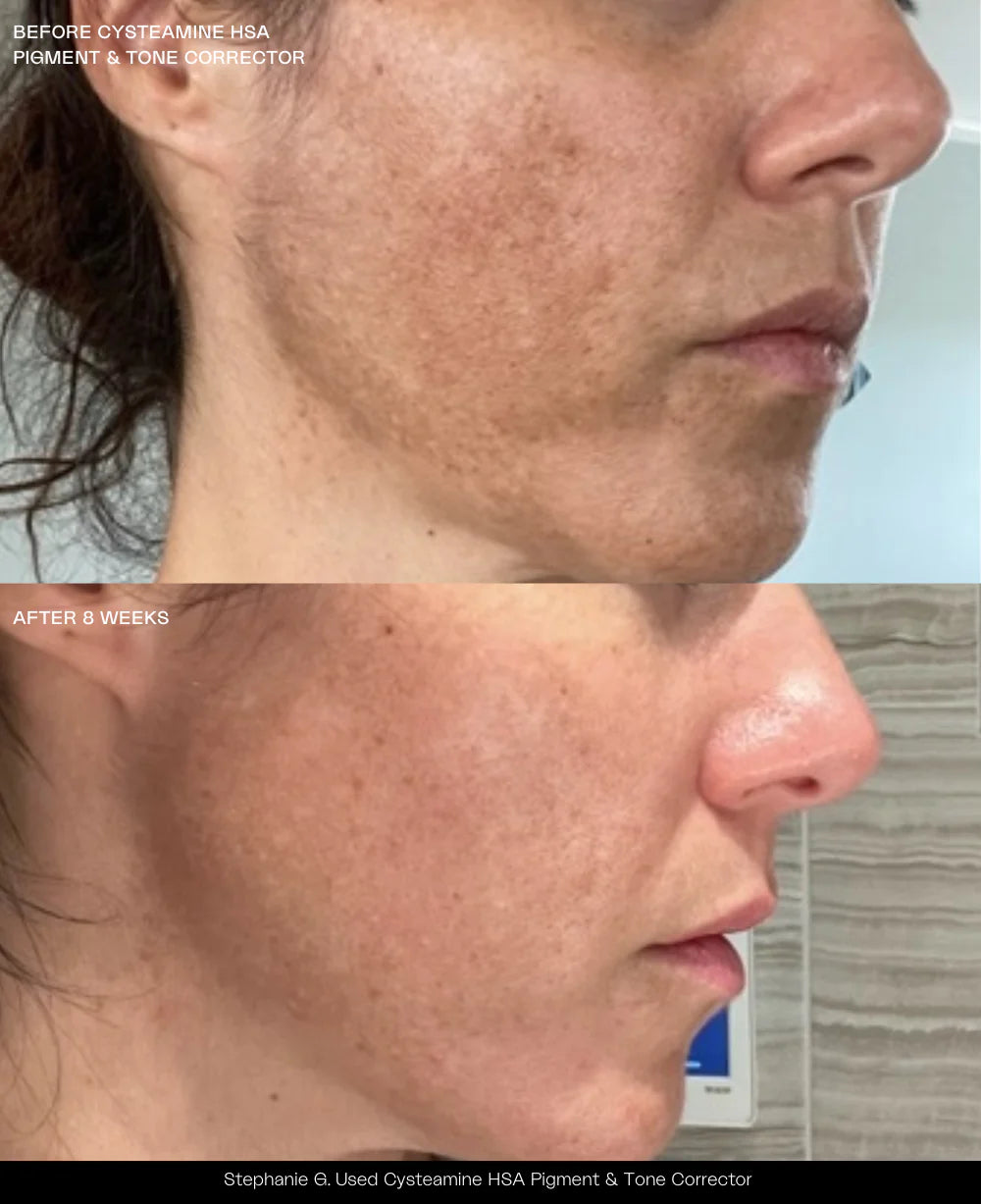 Sente Cysteamine HSA Pigment & Tone Corrector