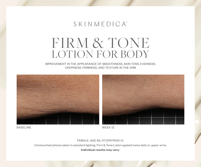 SkinMedica Firm & Tone Lotion for Body
