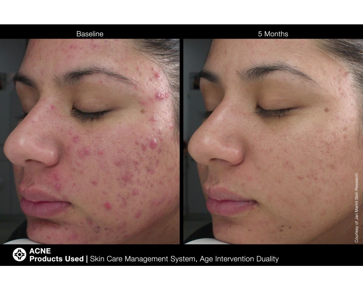 Jan Marini Age Intervention Duality