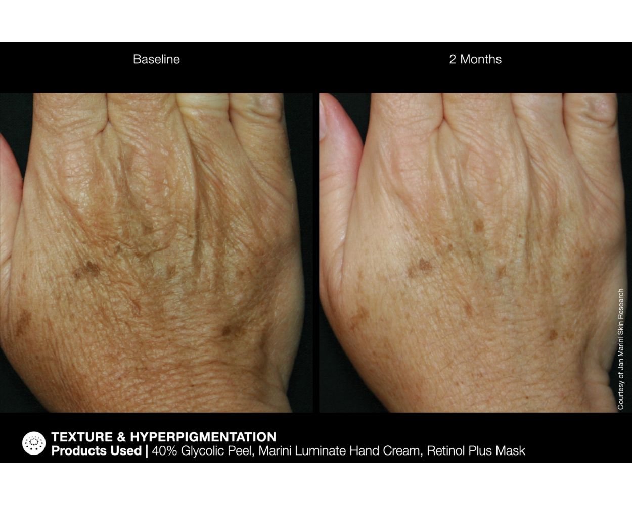 Jan Marini ReNu Corrective Hand Complex