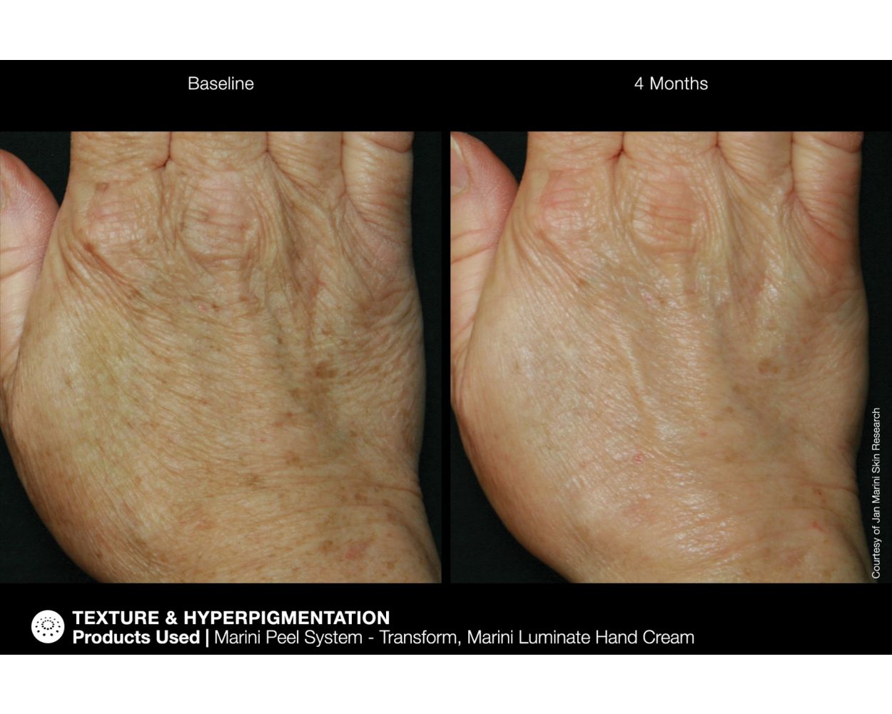 Jan Marini ReNu Corrective Hand Complex