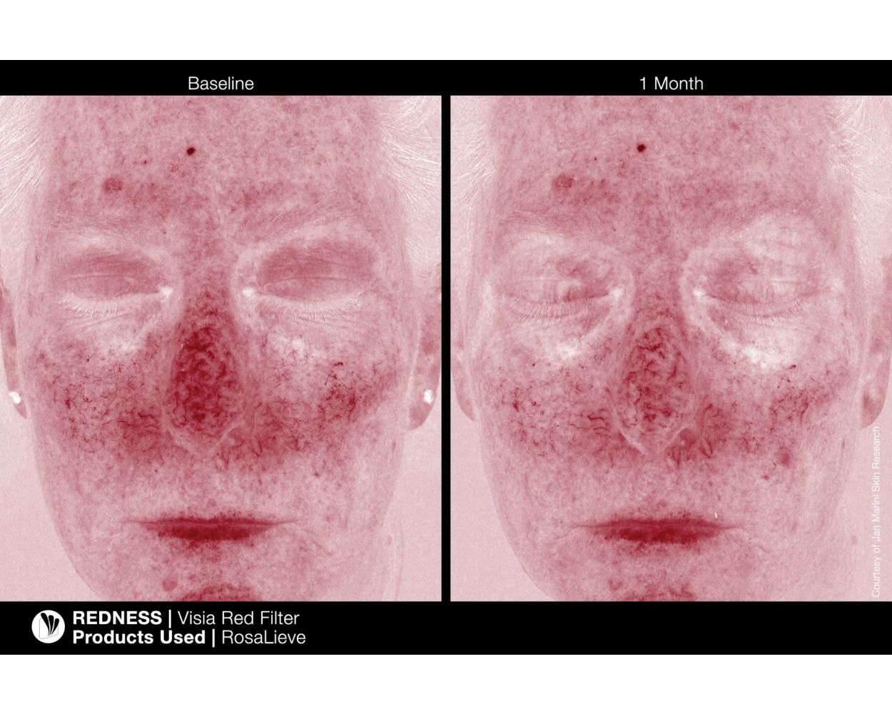 Jan Marini RosaLieve Redness Reducing Complex