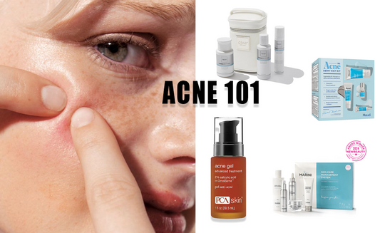 Top Effective Acne Treatments