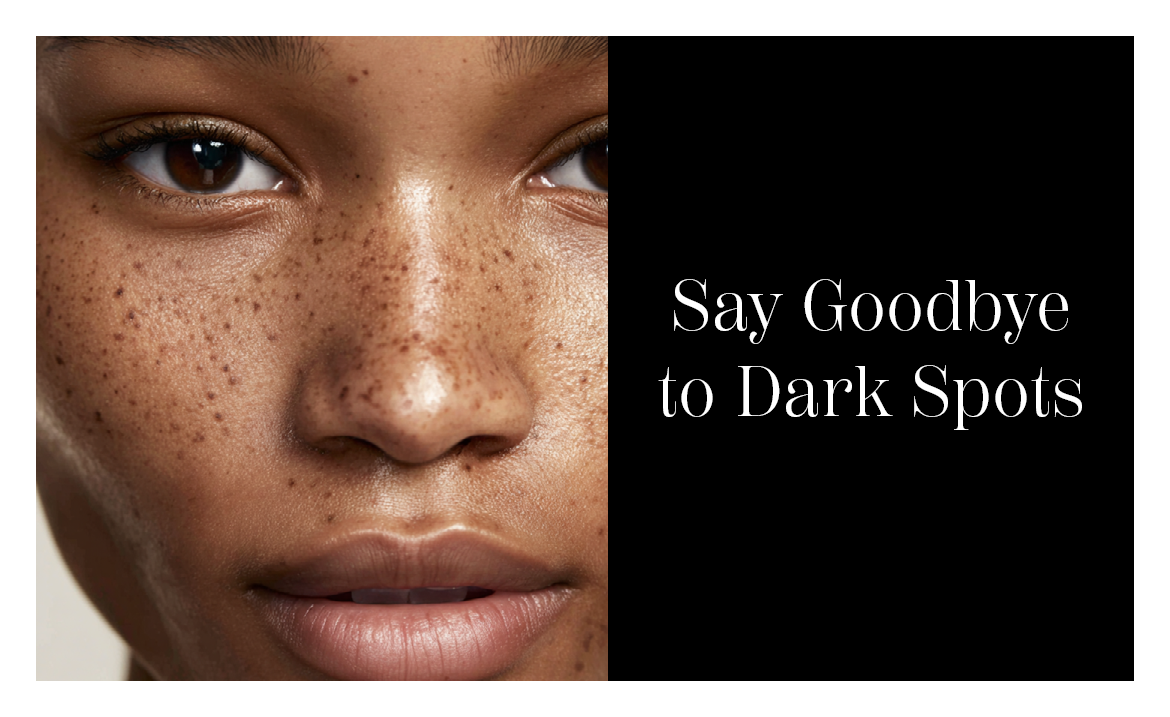 Discover the Best Remedies for Dark Spots