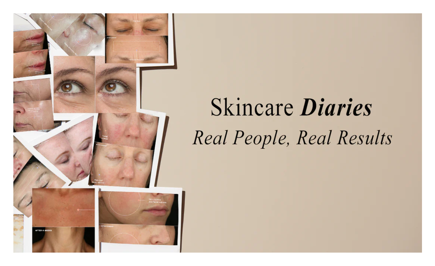 Skincare Diaries: Real People, Real Transformations