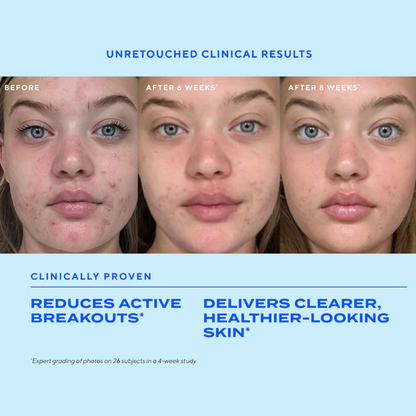 Murad Biome-Balancing Clear &amp; Prevent Acne Treatment Serum