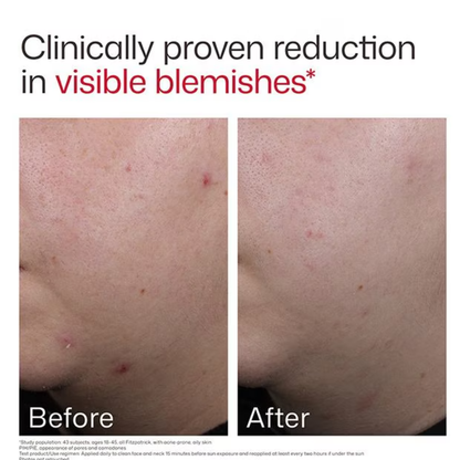 Eltamd UV Clear Blemish &amp; Oil Balancing SPF 50