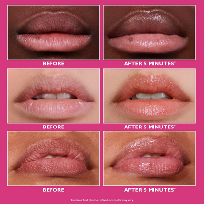 Peter Thomas Roth Instant FIRMx Lip Filler