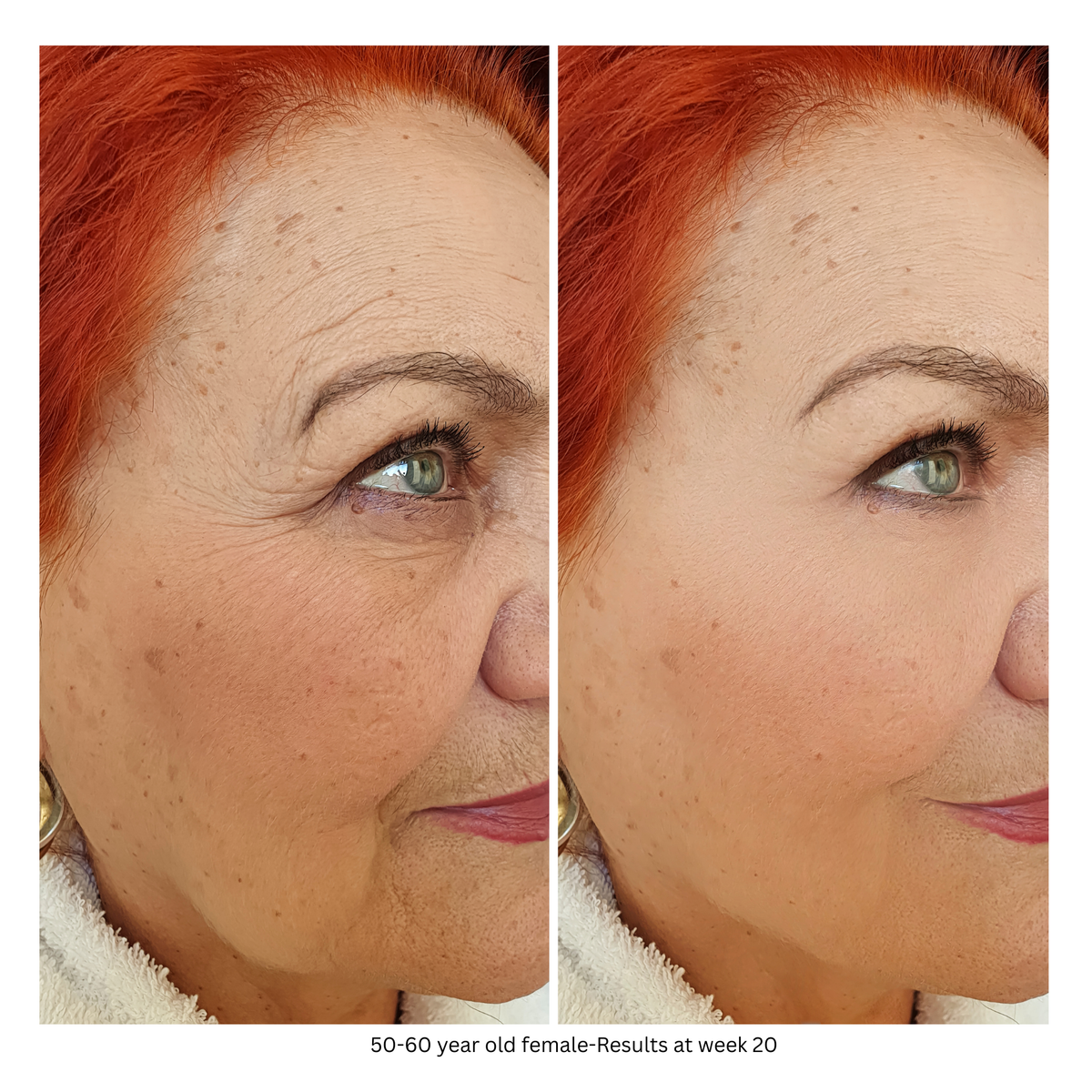 SkinCeuticals C E Ferulic 1 fl oz. SOLD OUT-Buy 1 Dermavenue C E Essential Serum Get a Your Second Bottle FREE (Copy)