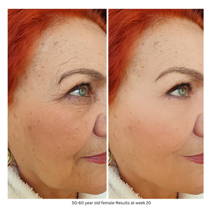 SkinCeuticals C E Ferulic 1 fl oz. SOLD OUT-Buy 1 Dermavenue C E Essential Serum Get a Your Second Bottle FREE (Copy)