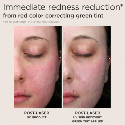 EltaMD UV Recovery Red Color Correcting Green Tint Broad Spectrum SPF 50