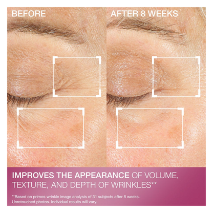 StriVectin Advanced Retinol Multi-Correct Eye Cream