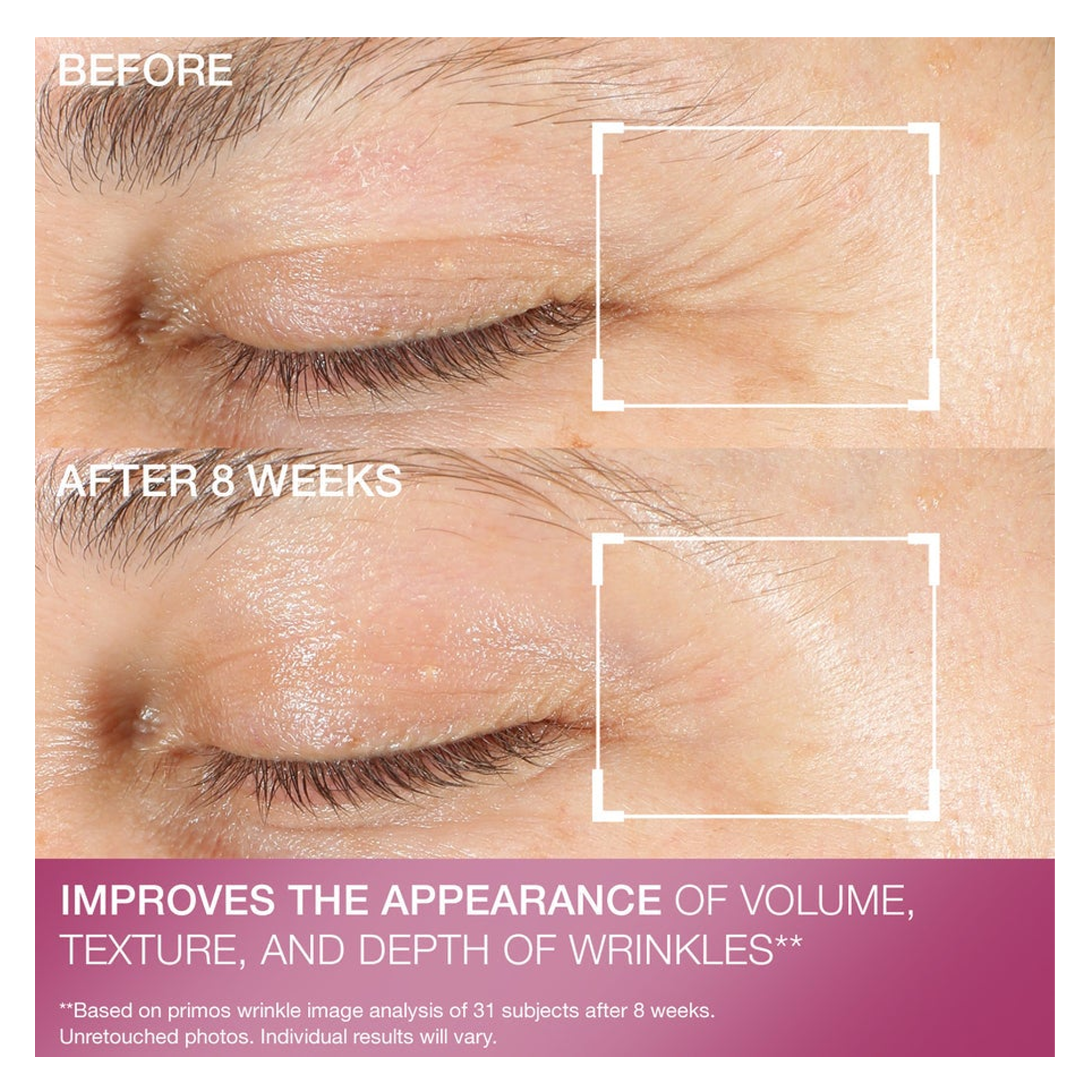 StriVectin Advanced Retinol Multi-Correct Eye Cream