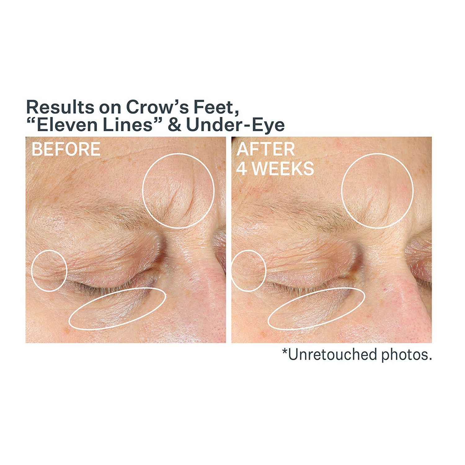 StriVectin Anti-Wrinkle Intensive Eye Concentrate For Wrinkles PLUS