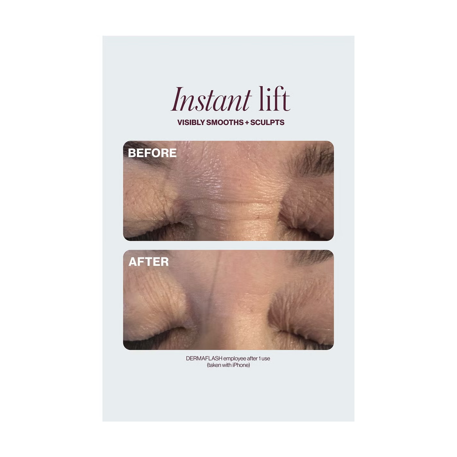 DERMAFLASH Cool Sonic Depuffing and Lymphatic Drainage Set