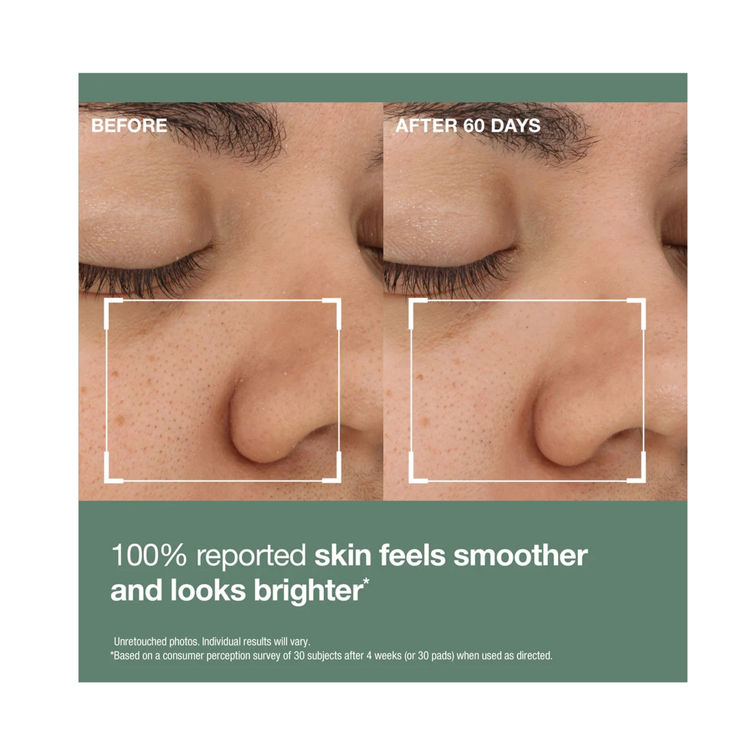 StriVectin Advanced Resurfacing Daily Reveal Exfoliating Pads