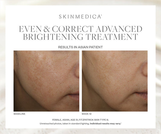 SkinMedica Travel Size Even & Correct Advanced Brightening Treatment