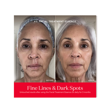 SK-II PITERA Anti-Aging Set: Best Skincare Bundle