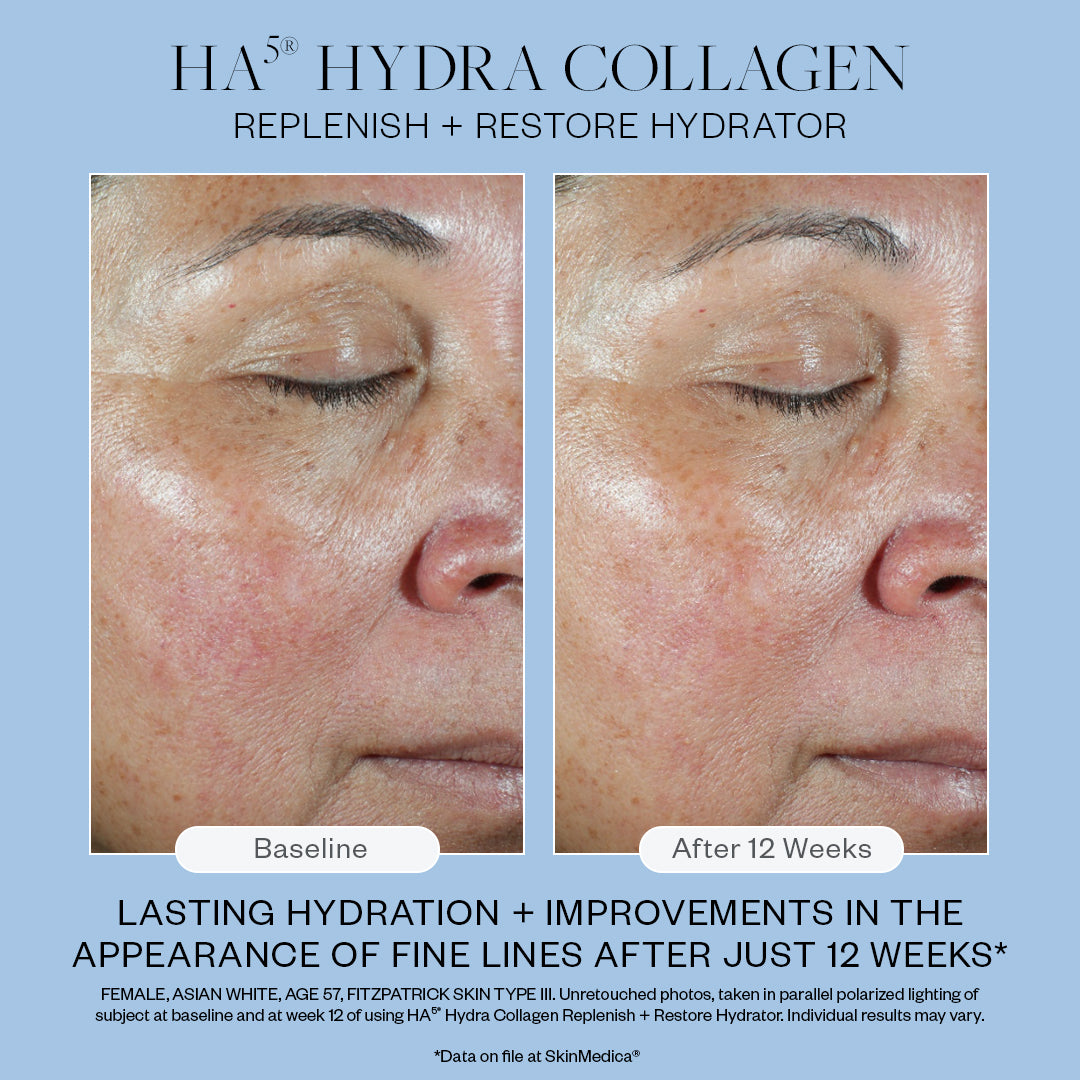 SkinMedica HA5 Hydra Collagen Replenish &amp; Restore Hydrator