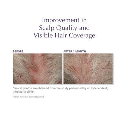 DefenAge 150K Hair Follicle Serum